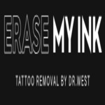 Erase My Ink